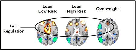 Increased Brain Activity When Viewing Food Cues