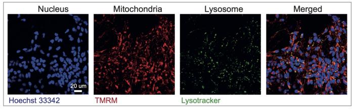 Nerve cells in the cortex of the brain generated from patient's stem cells