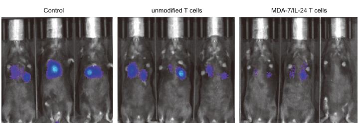 Engineered T cells Combat Cancer in Mice