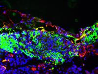 Salk Scientists Find 'Secret Sauce' for Personalized, Functional Insulin-Producing Cells