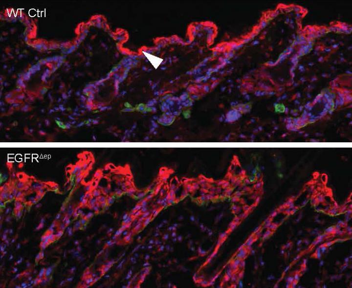 Rebellious Microbiota Contribute to Skin Damage in Some Cancer Treatments (4 of 4)