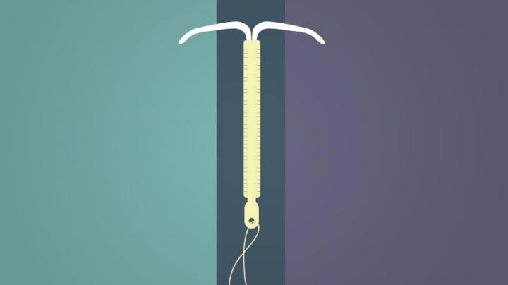 IUD illustraton