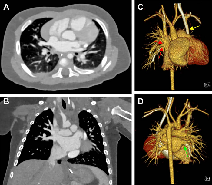 Imaging in Babies with Heart Defects