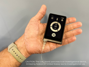 iLet bionic pancreas device