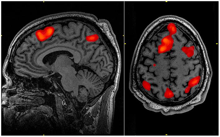 FMRI Scan