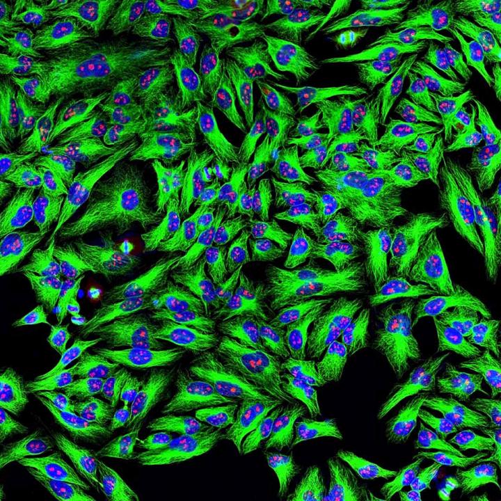 Monoclonal Antibodies Bound to HeLa Cells