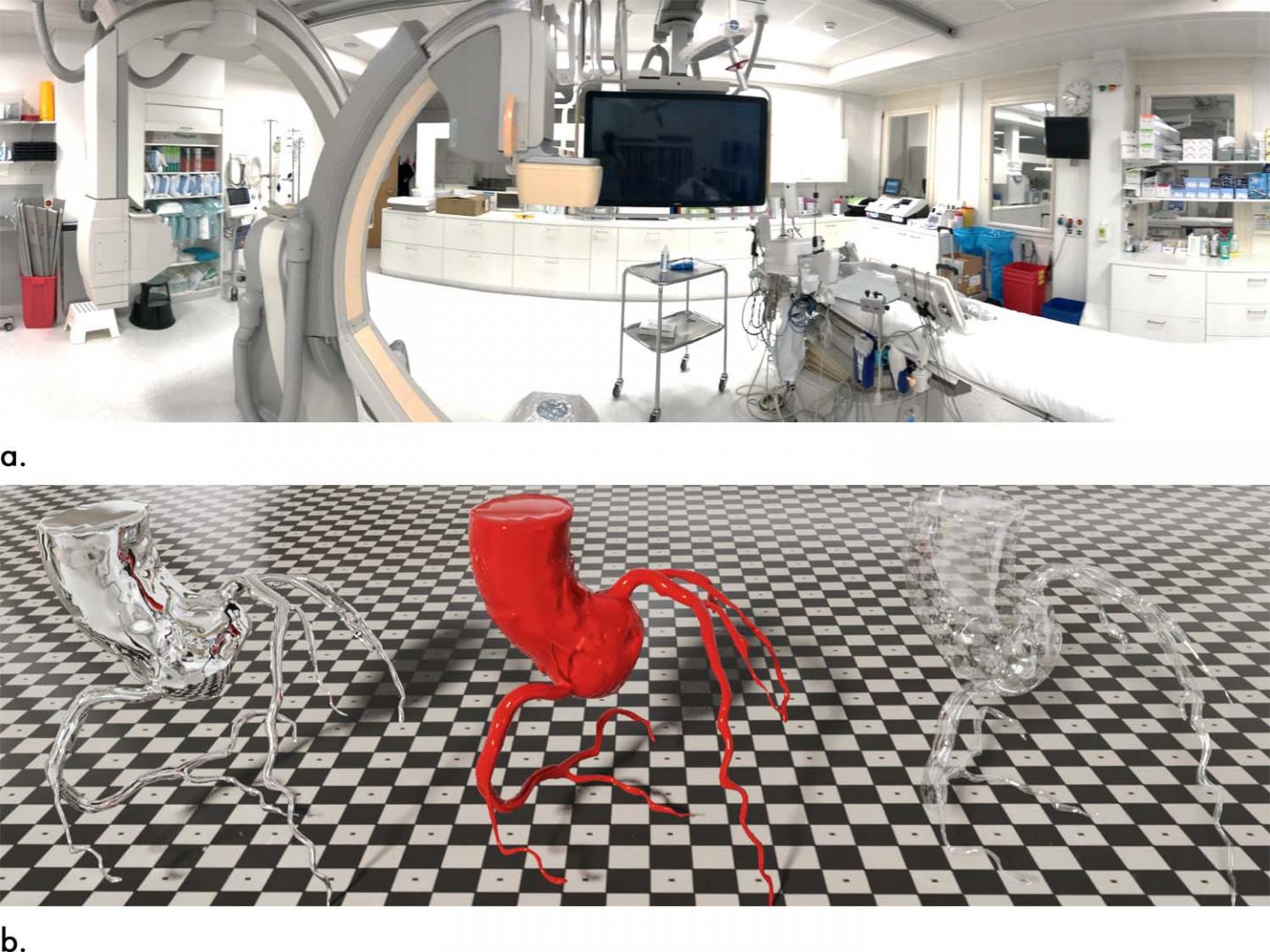 3D Fusion Imaging Improves Coronary Artery Disease Diagnosis