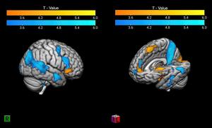 The contrast of winning and losing in the “good Fanatic brain.”