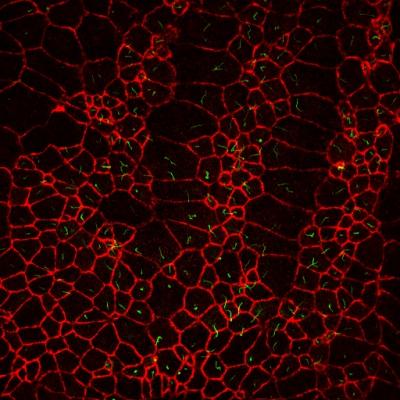 FoxJ1 Helps Cilia Beat a Path to Asymmetry