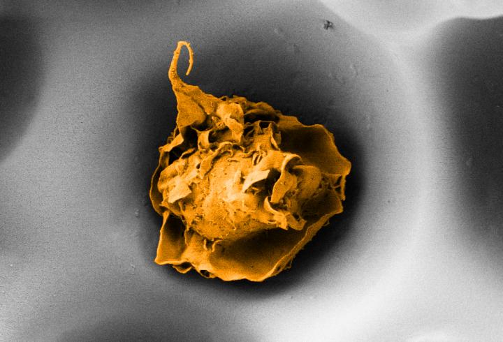 Macrophage in a Pore