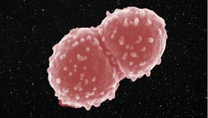 Extremophile organisms: Deinococcus radiodurans. Science blog 121