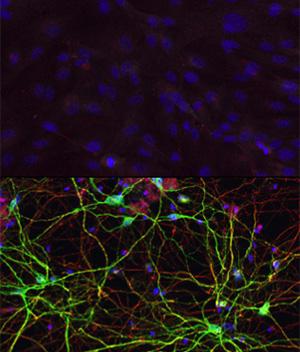 Skin Cells and Neurons
