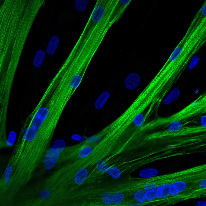 Gene editing in human muscle stem cells