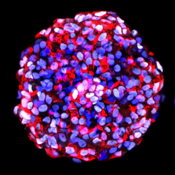 Stem cell-derived beta cell cluster.