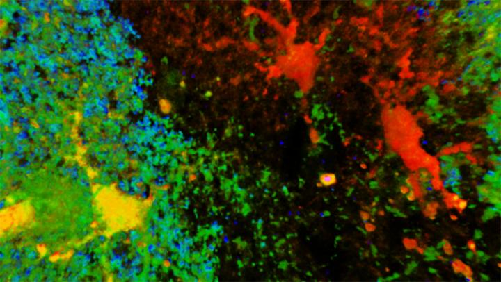 Cortical Grey Matter