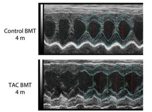 Echocardiography of mice hearts