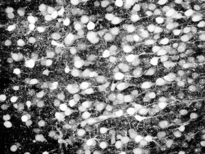 Firing Neurons in the Visual Cortex Captured with Calcium Imaging Techniques