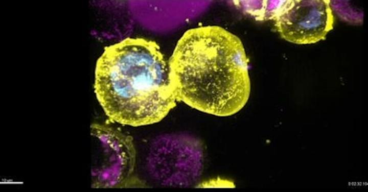 Cells Dying by Necroptosis