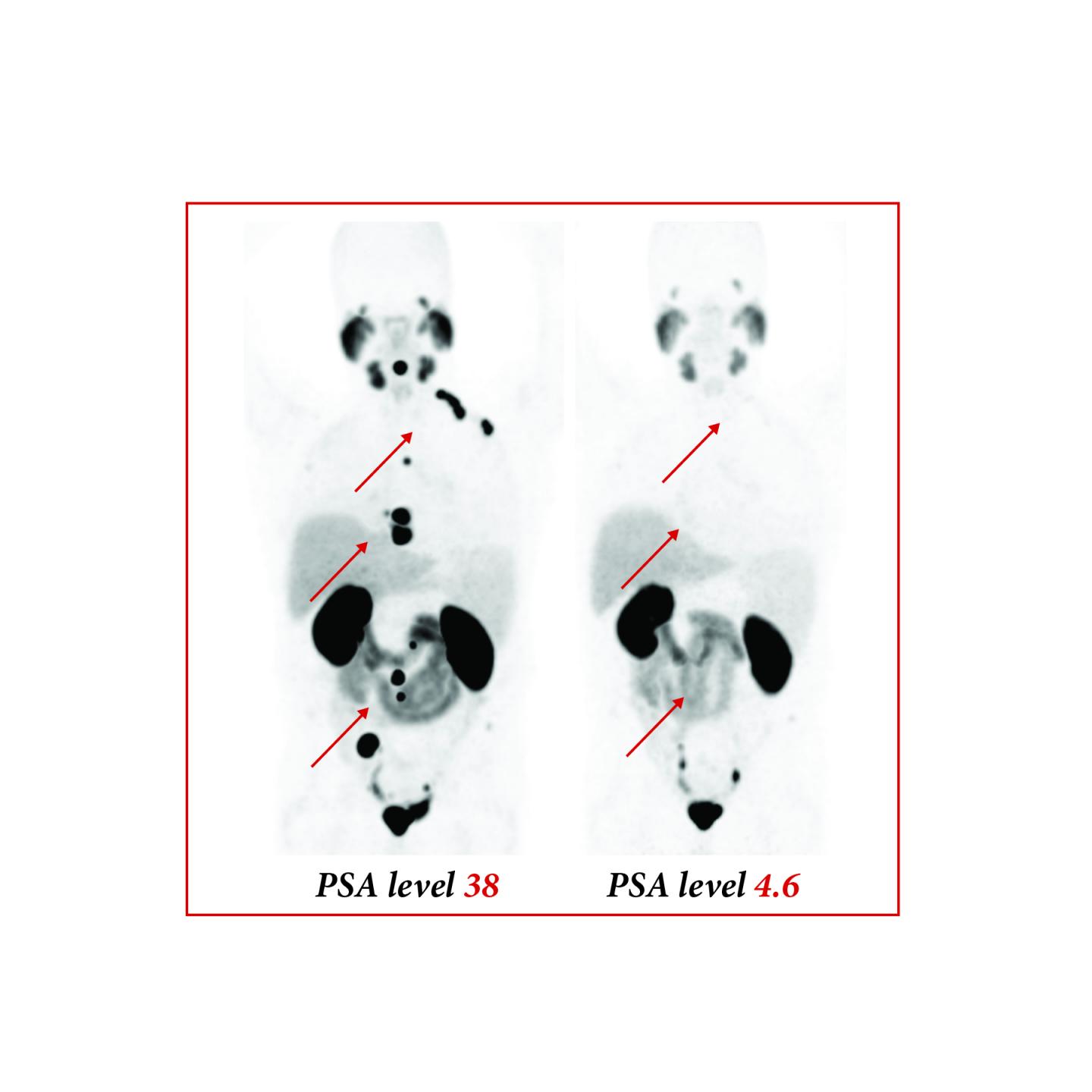 SNMMI Image of the Year