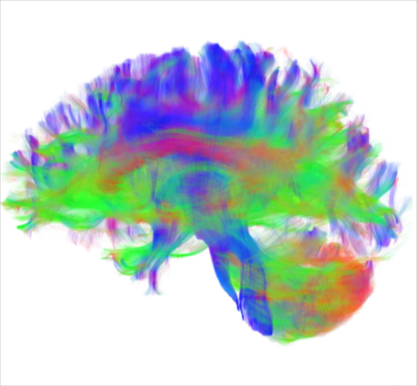 Diffusion Tractography