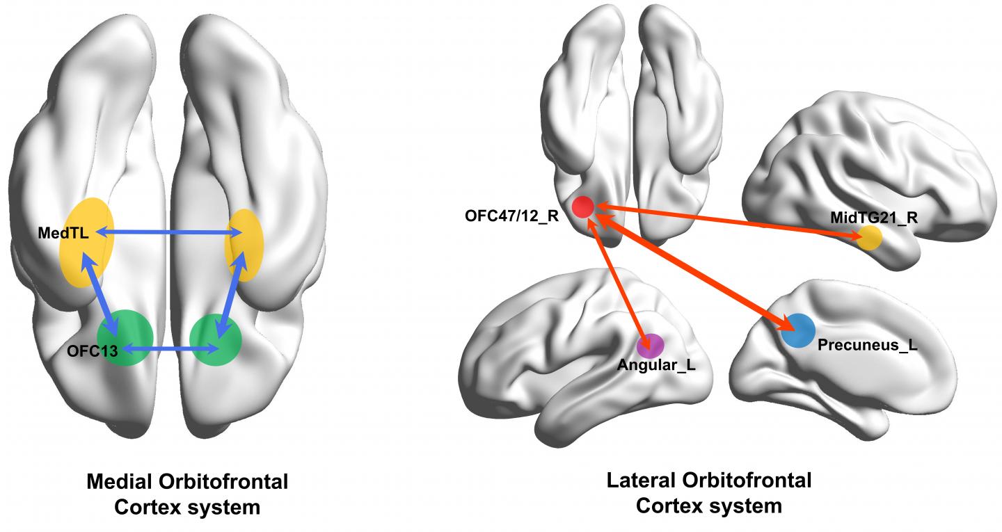 Diagram Showing Parts of the Brain Implicated in Depression