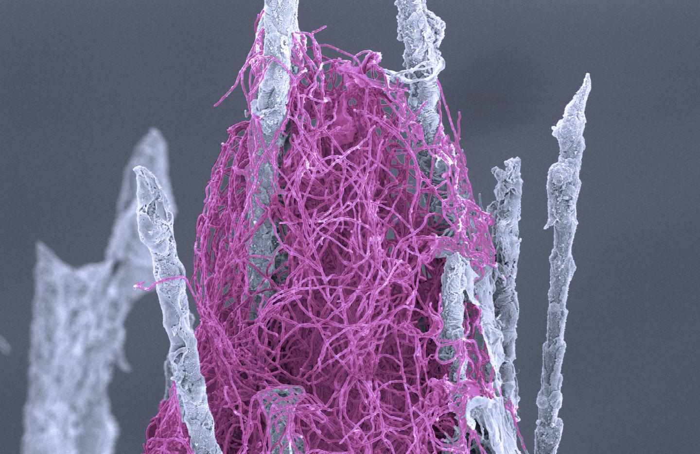 Pseudogymnoascus Destructans Cells