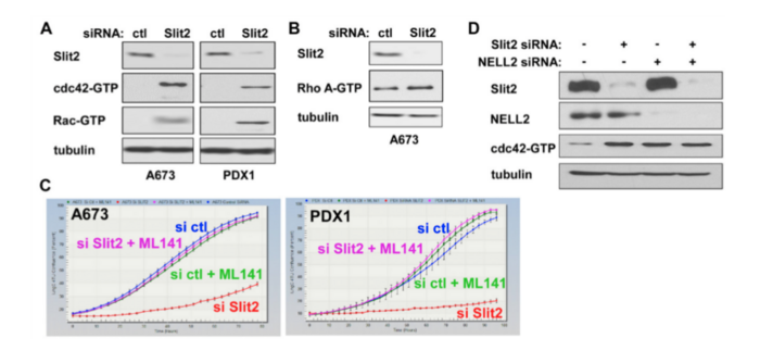 Biological And Histopathologic Distribution Of Ews Fli1 Bulk Ctls And