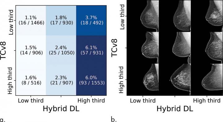 Novel Artificial Intelligence Method Predicts Future Risk of Breast Cancer