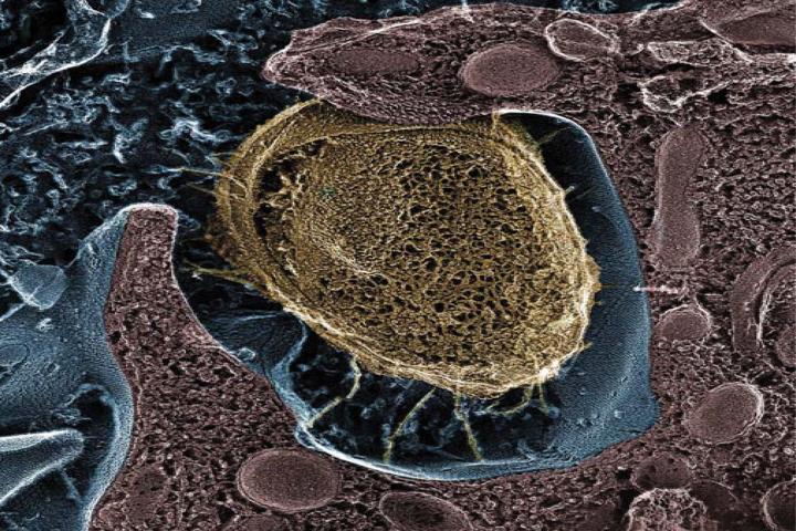 <i>E. coli</i> Invading Bladder