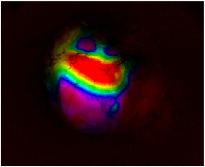 Brain-Wide View of Neural Circuitry