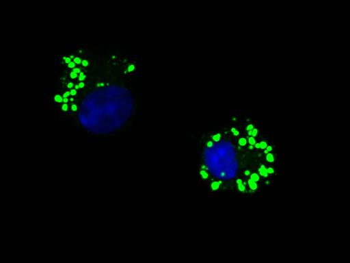 The Picture Shows Two Lymphoid Cells