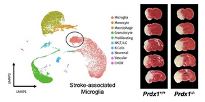 Peroxiredoxin1 (Prdx1) is essential for SAM activation after stroke damage.