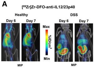 IL12/23p40 immuno-PET/CT imaging of healthy and DSS-treated mice.