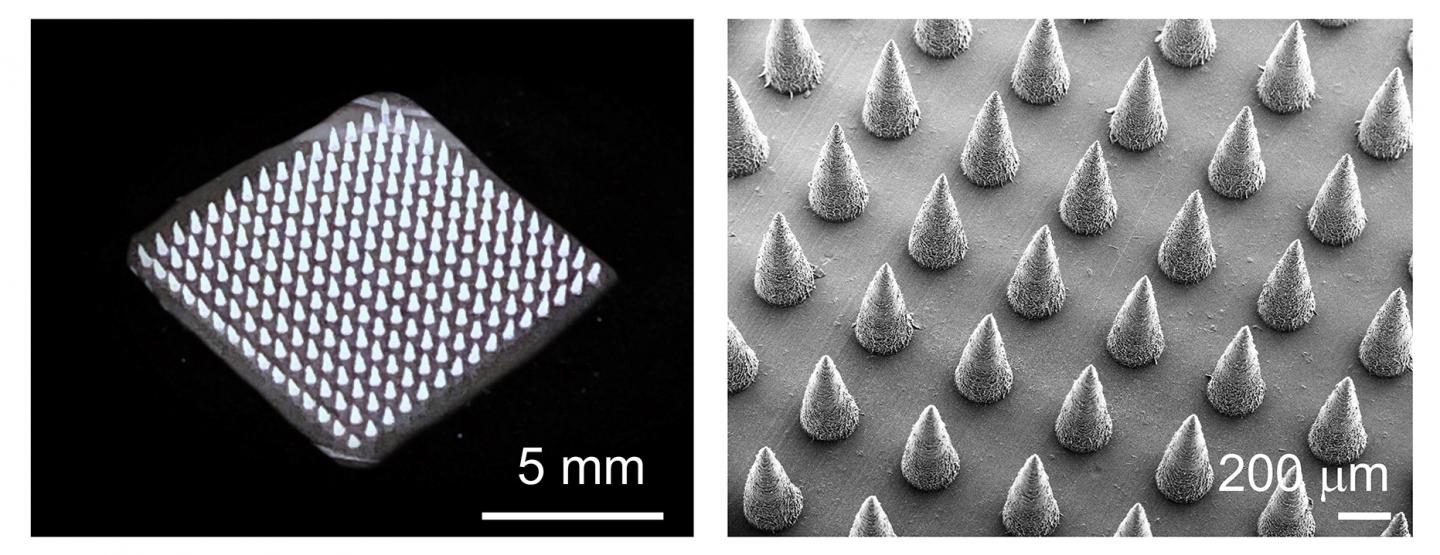 Microneedle Patch [IMAGE] EurekAlert! Science News Releases