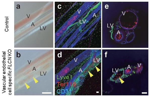 Mechanisms that Maintain the Separation of Blood Vessels and Lymph Vessels