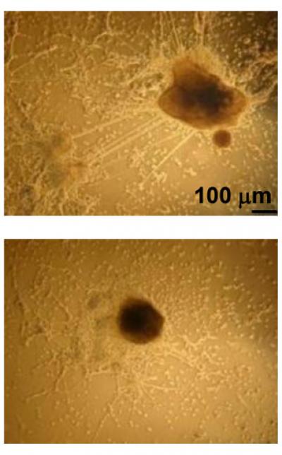 H1 Histone Neural Impairment
