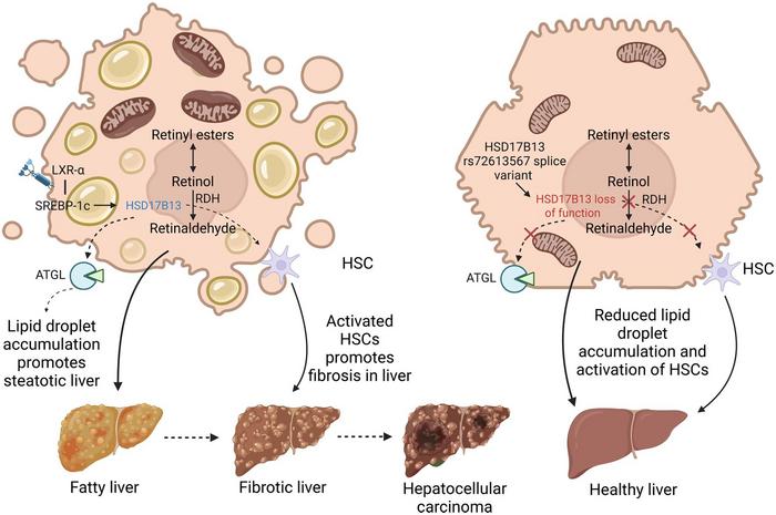 Decoding 17-Beta-hydroxysteroid Dehydrogenase 13: A Multifaceted Perspective on Its Role in Hepatic Steatosis and Associated Disorders