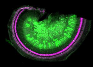 Images show part of the uncoiled mouse cochlea, after treatment with the gene therapy (green). In pink, the all important sensory hair cells can be seen, preserving hearing in mice with Norrie disease.