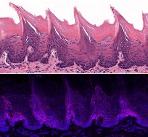 ORAI1 and oral cancer