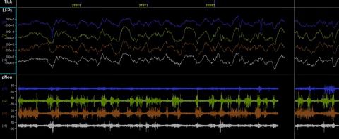 Electrophysiological Signals