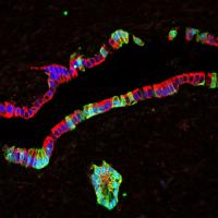 Pancreatic Ducts Harbor Progenitor-Like Cells