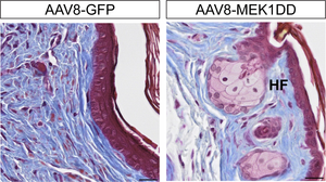 Hair follicle formation after ERK activation.