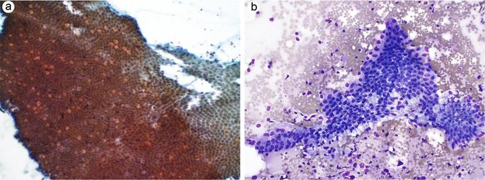 Gastrointestinal contaminant