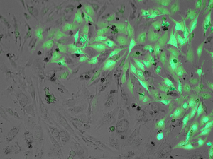 Glioblastoma strategy