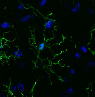 Brain's Immune Cells Linked to Alzheimer's, Parkinson's, Schizophrenia