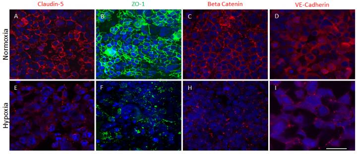 Human Cortex Spheroid with a Functional Blood Brain Barrier