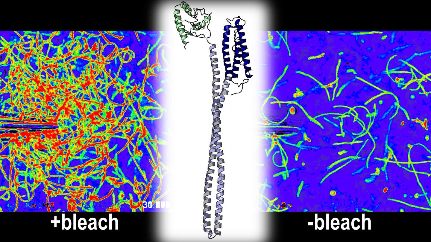 H. pylori Uses TlpD to Sense Bleach