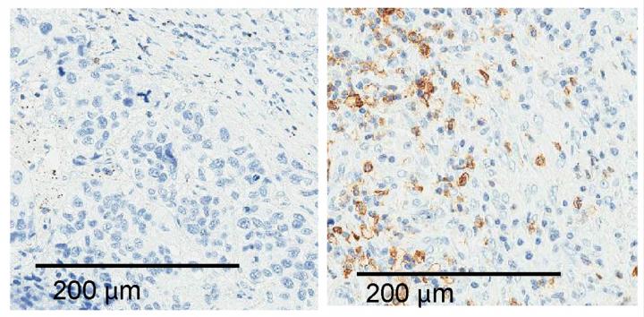 ALAL-1 Promotes Immune Evasion
