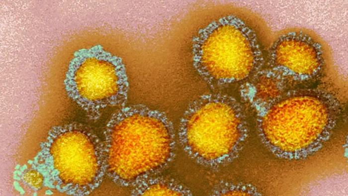 Electron microscopy image of influenza viruses