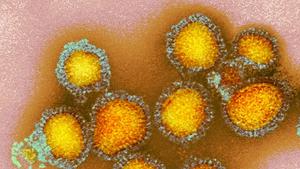 Electron microscopy image of influenza viruses